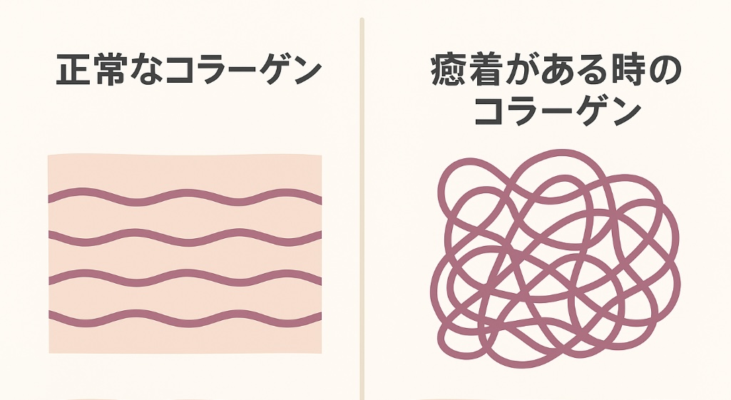 コラーゲンと脂の違い