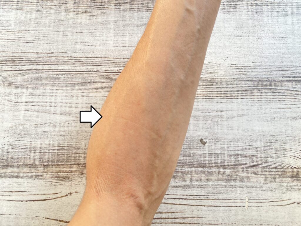 YAP遺伝子　女性　特徴